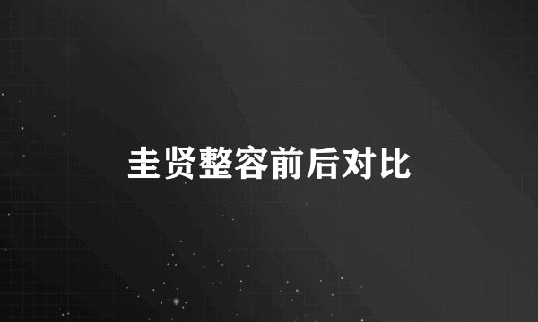 圭贤整容前后对比