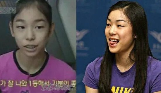 韩国女运动员有没有整容的？