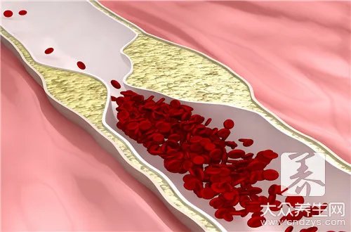 乳糜血是什么意思
