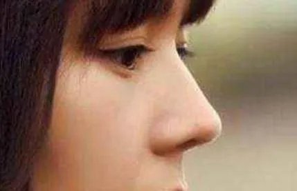 合肥固体硅胶垫鼻美容整形医院有哪些_正规固体硅胶垫鼻医疗整形医院哪里好【附价格】