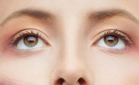 一般割双眼皮大概要多少钱