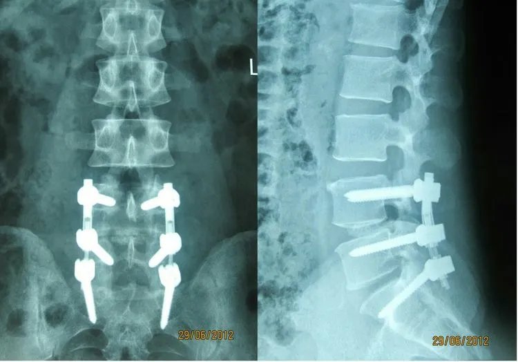 郑州市骨科医院脊柱二科科室简介
