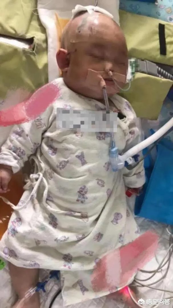 广州一女子被高空掉落的狗砸成重伤你怎么看?