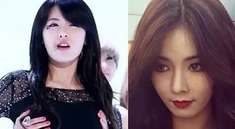 金泫雅mv甩奶舞撩人 女星金泫雅整容疑云