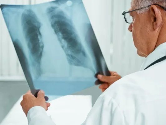 如何预防肺癌术后复发