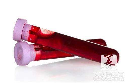 乳糜血是什么意思