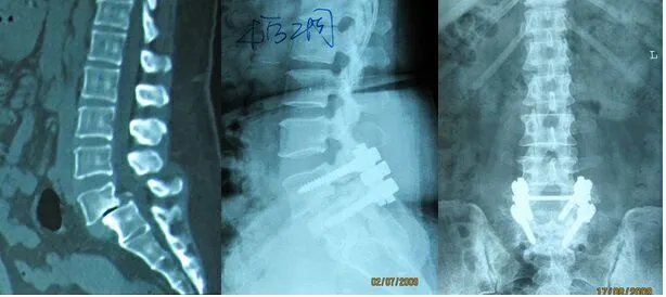 郑州市骨科医院脊柱二科科室简介