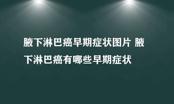腋下淋巴癌早期症状图片 腋下淋巴癌有哪些早期症状