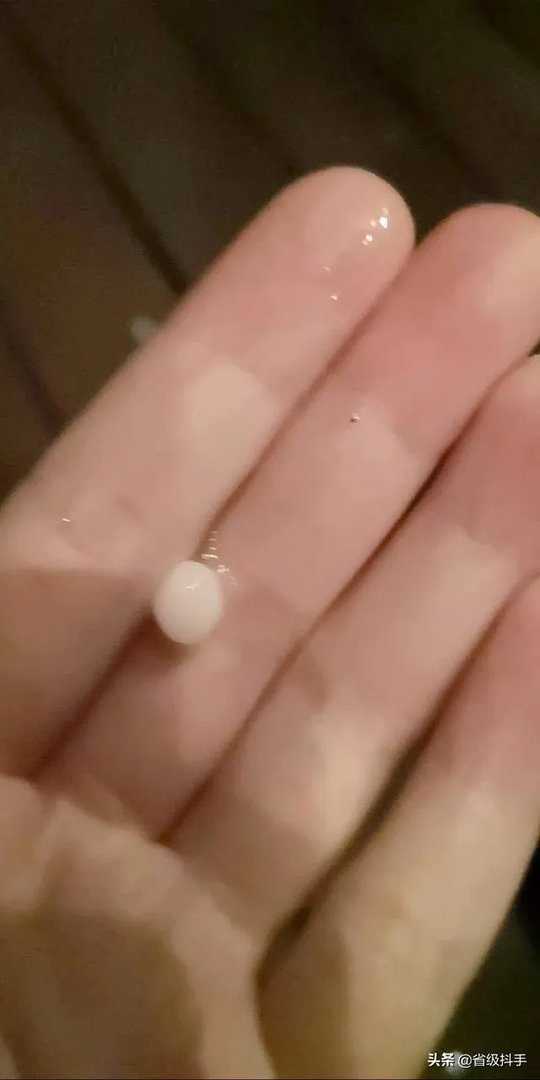 重庆冰雹灾害怎样了？