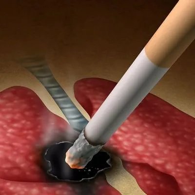 早起肺癌的治疗方法