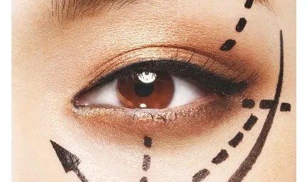 请问割双眼皮价格是多少钱啊