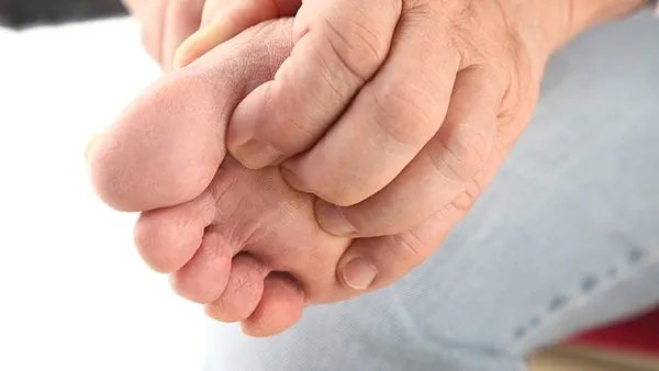 手心脚心发热是怎么回事