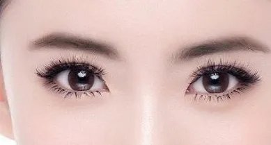 微创双眼皮一般多少钱