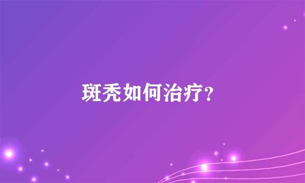 斑秃如何治疗？