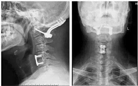 郑州市骨科医院脊柱二科科室简介