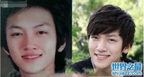 池昌旭整容前后照片对比，整容前也是一名花美男 
