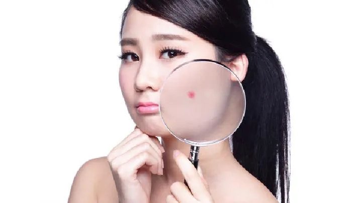 溢脂性皮炎的症状有哪些？