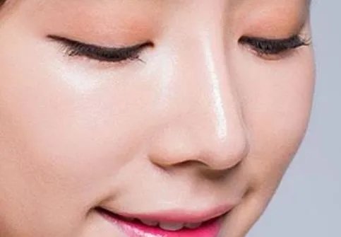 朝天鼻整形需要多少钱