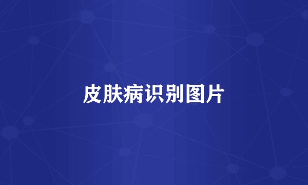 皮肤病识别图片