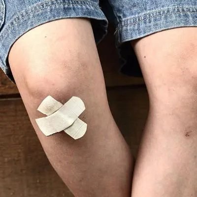 滑膜炎怎么治疗方法