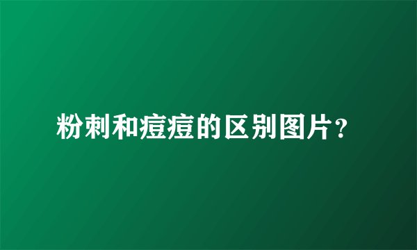 粉刺和痘痘的区别图片？