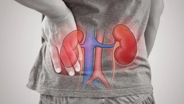 肾结石有什么症状表现