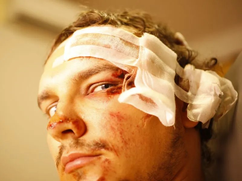 跌打损伤的治疗方法