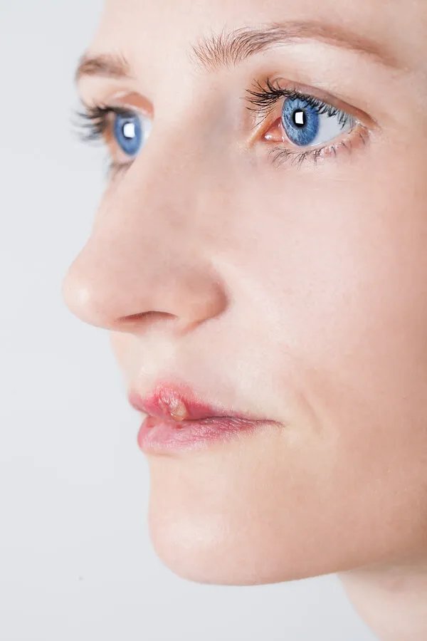 打一针美白要多少钱