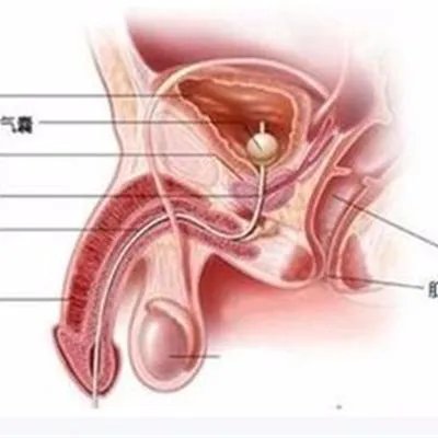 睾丸胀痛是什么原因