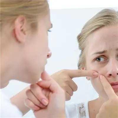 脸上痘印怎么去