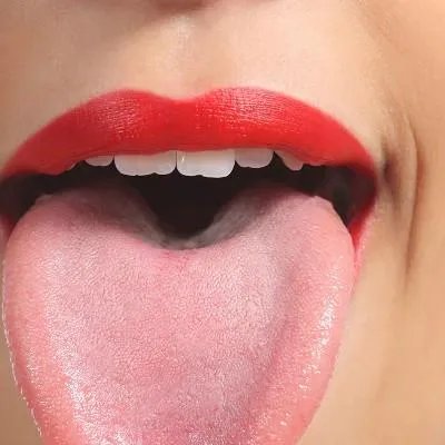 游走性舌炎是什么原因