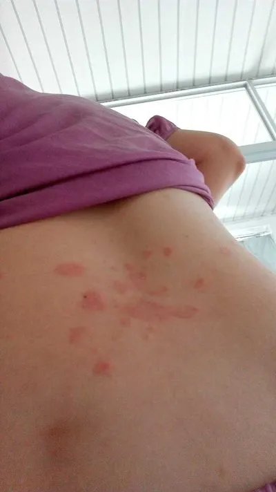 宠物真菌皮肤病症状?