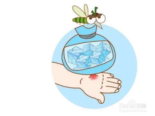 被恙螨咬了怎么处理？