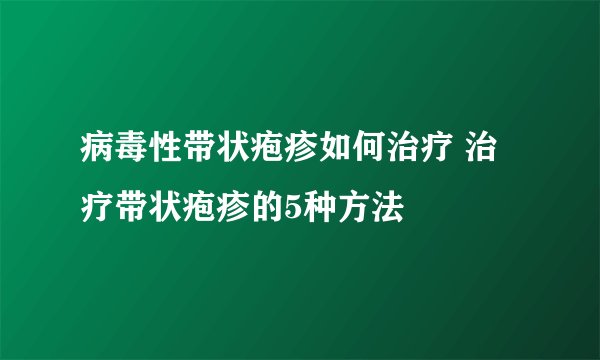 病毒性带状疱疹如何治疗 治疗带状疱疹的5种方法
