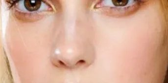 法令纹怎么去掉