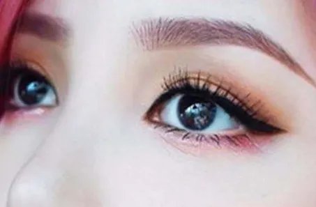 上睑下垂矫正术要多少钱啊