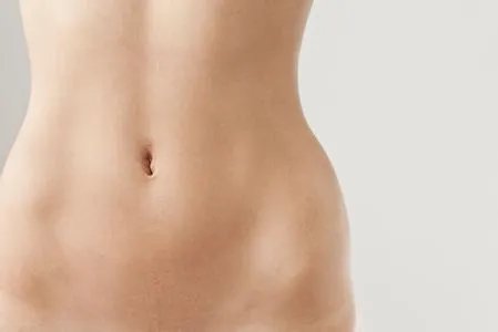 抽脂手术反弹吗