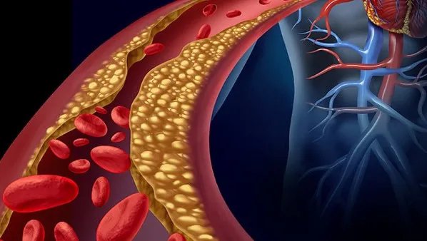 血液粘稠怎么办