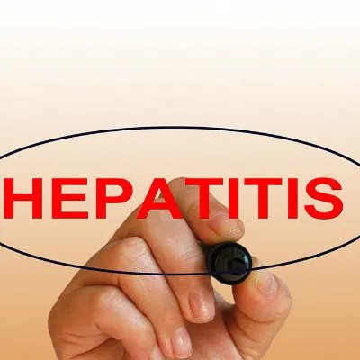 光过敏的原因,光过敏怎么引起的