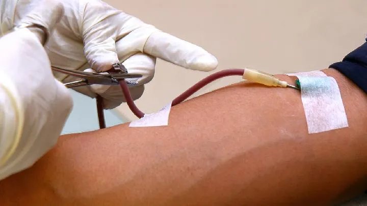 血小板减少性紫癜检查