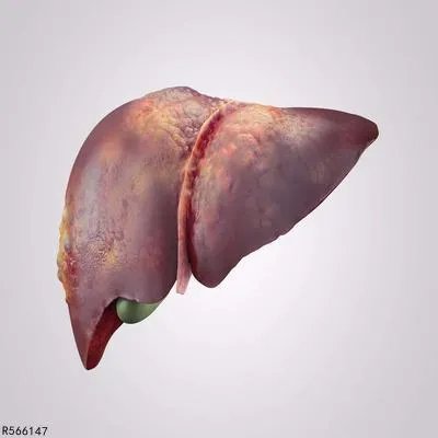 肝功能碱性磷酸酶偏高怎么办