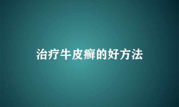 治疗牛皮癣的好方法