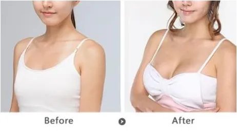 上海丰胸多少钱