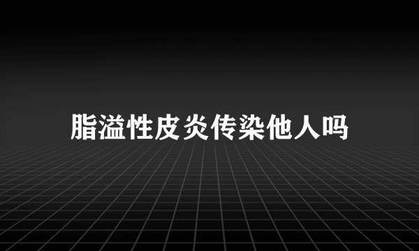 脂溢性皮炎传染他人吗