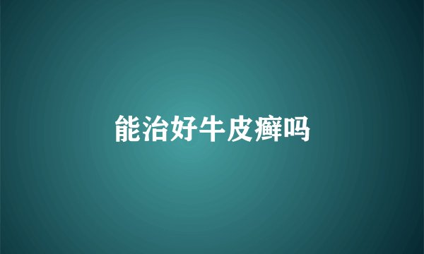 能治好牛皮癣吗