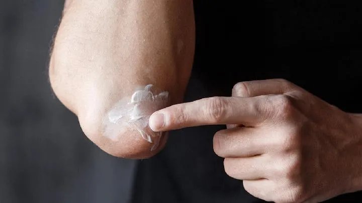 良好的生活习惯可以预防白癜风