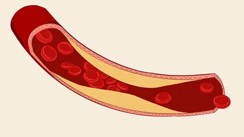 什么叫骨髓穿刺检查