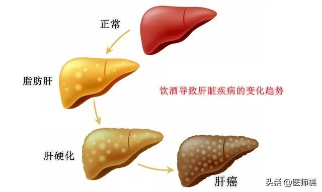 肝硬化前兆有哪些症状？