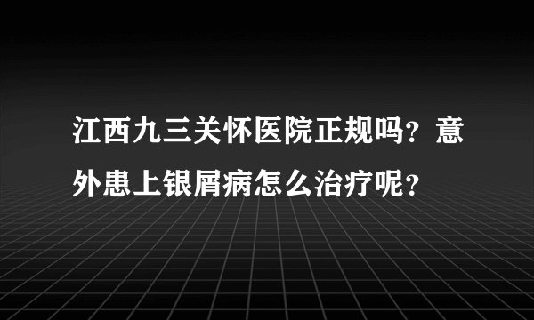 江西九三关怀医院正规吗？意外患上银屑病怎么治疗呢？