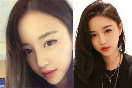 雪梨张衍订婚秀恩爱撒狗粮前男友国民老公王思聪寻新欢